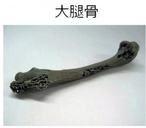チタン製骨